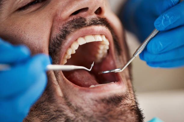 Best Walk-In Emergency Dentist in Innsbrook, VA